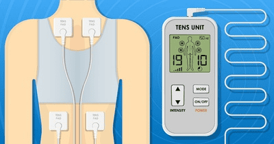 Infographic die uitlegt wat TENS is: klein elektrotherapie-apparaat met elektrodepads op de rug, met stappen hoe TENS pijnsignalen blokkeert en wanneer je moet oppassen.
